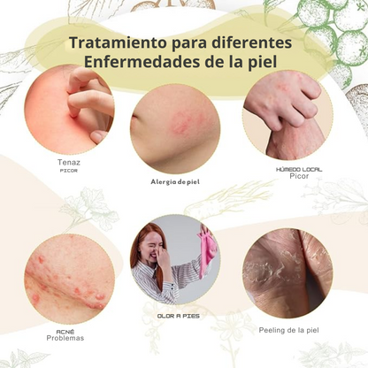 Crema herbaria natural avanzada original para psoriasis y eczema