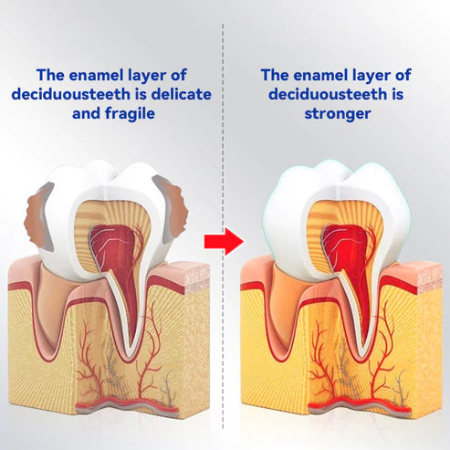 Pasta dental anticaries para la salud de las encías Oraliz™ (recomendada por dentistas)