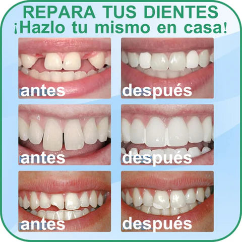 Moldeador para dentadura 🦷